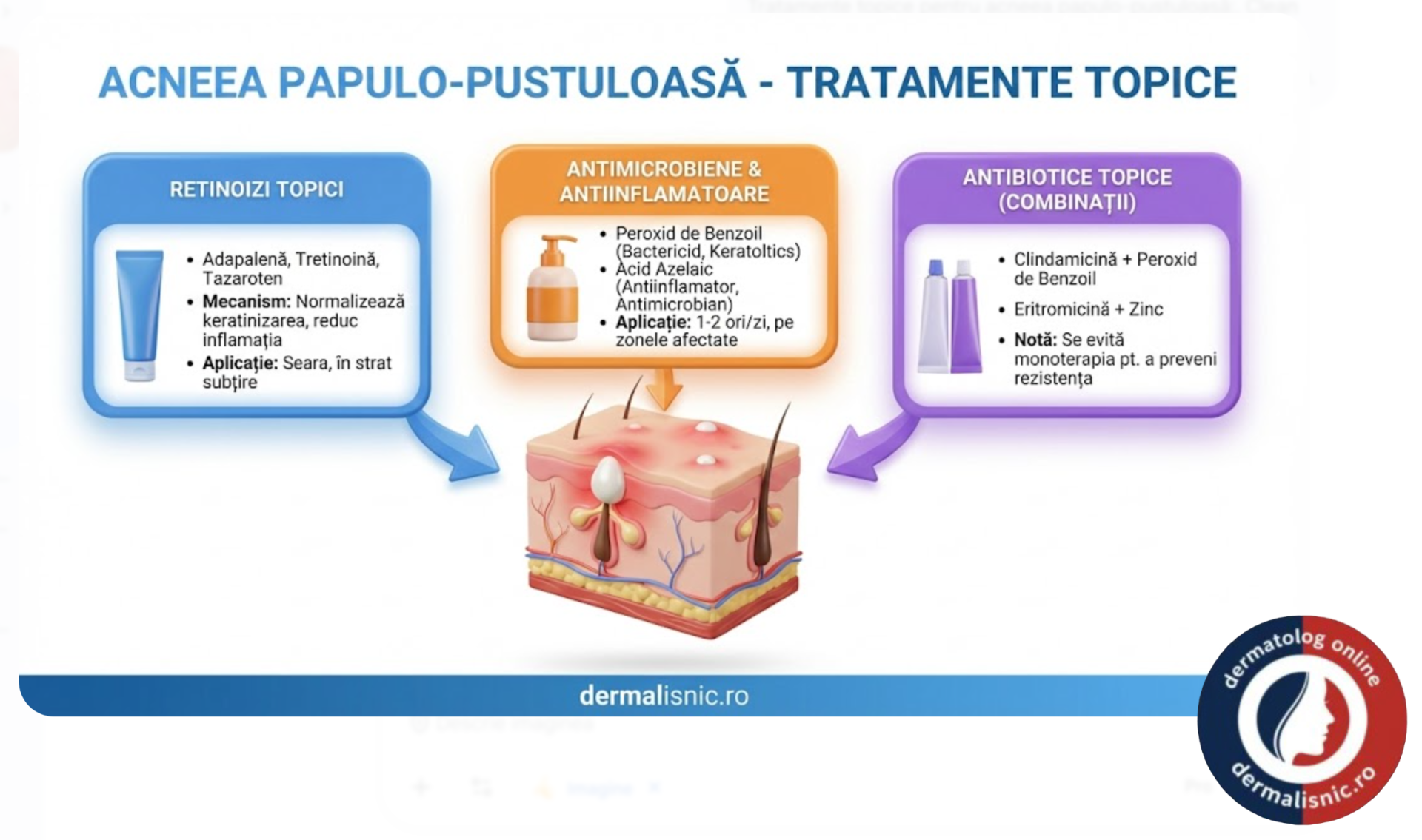 acneea papulo-pustuloasă - Tratamente topice pentru acneea papulo-pustuloasă: