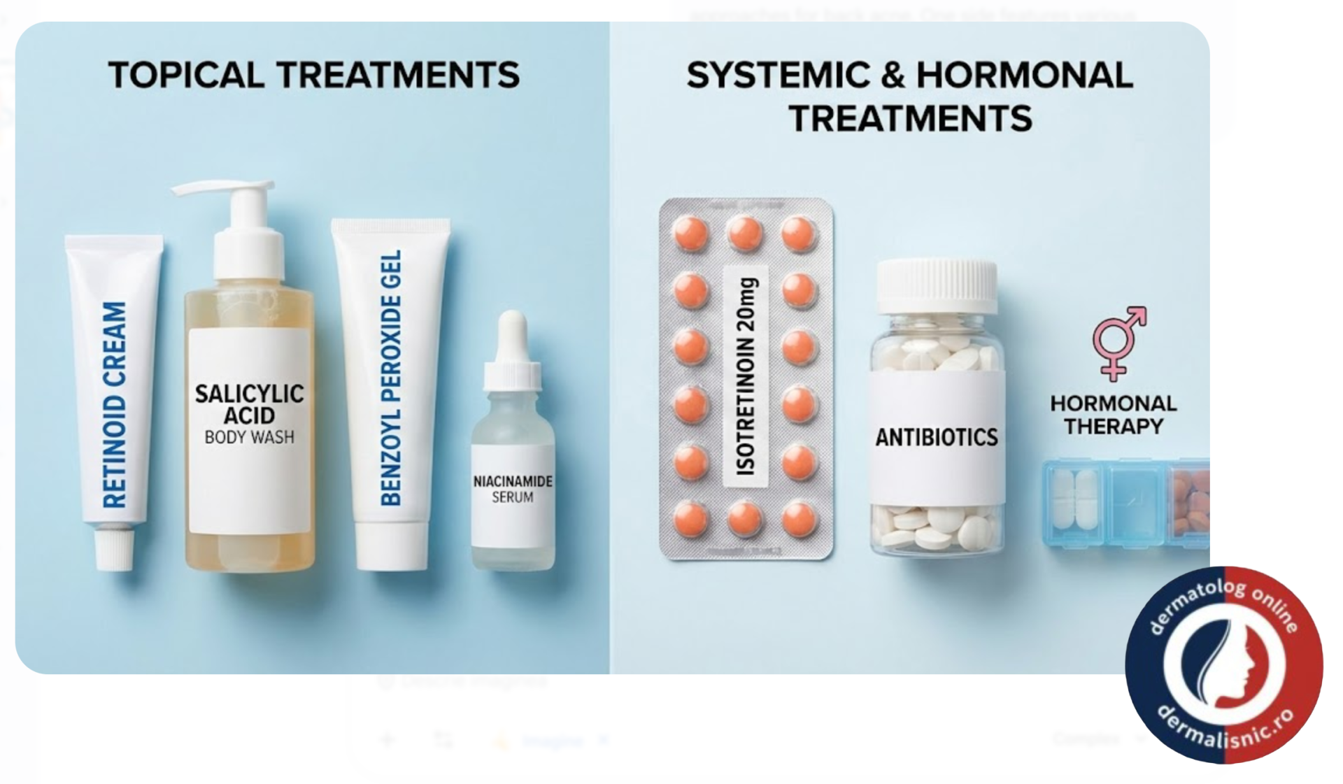 O imagine compozită care prezintă diverse metode de tratament pentru acneea pe spate: produse topice (retinoizi, peroxid de benzoil, acid salicilic) și medicamente sistemice (antibiotice, isotretinoină, terapii hormonale).
