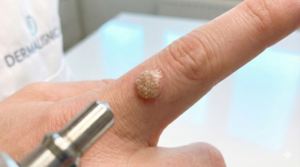 Imagine regenerată pentru Imagine Reprezentativă (Copertă)